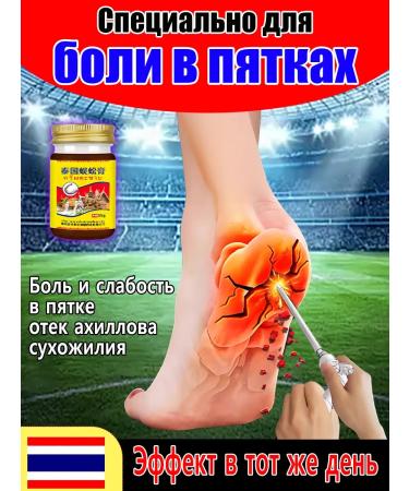 An ointment in heel pains and for joints anesthetic