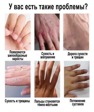 Hand cream with a moisturizing and brightening effect - Buy Online on GoSupps.com