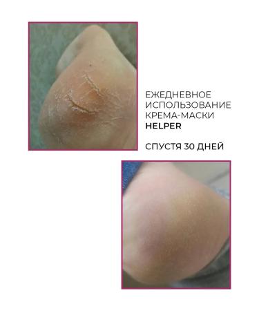 ROSILAK A set of means from eczema dermatitis psoriasis - Buy Online on GoSupps.com