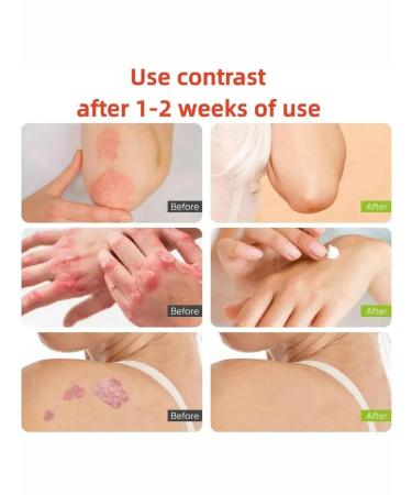 LATIBEAUTYFUL Anti -inflammatory cream for skin - Buy Online on GoSupps.com