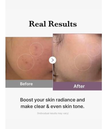 Medicube Clarifying cream with glutathione capsules - Buy Online on GoSupps.com