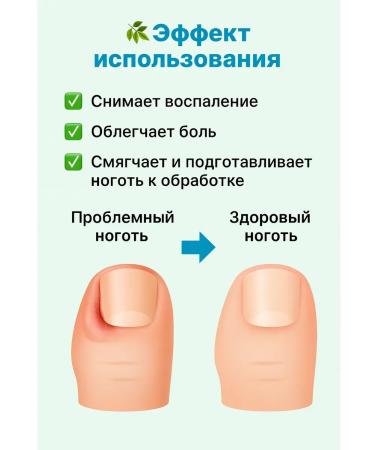 kan3 Loton Loton to soften ingrown nails and relieve pain - Buy Online on GoSupps.com