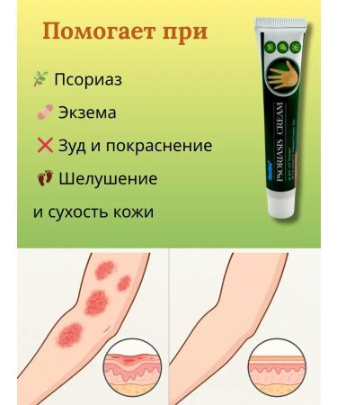 house 78 Cream for skin health from psoriasis - Buy Online on GoSupps.com