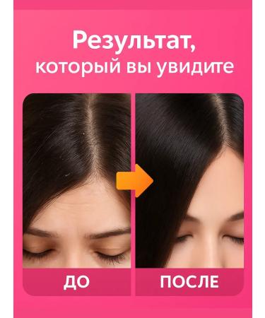 NAZKA21 Fifty shampoo Therapeutic female and male - Buy Online on GoSupps.com