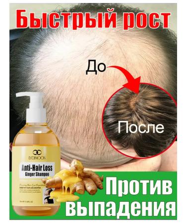 LYDIMOON Shampoo with ginger for hair from falling out professional