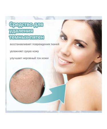 eelhoe Face cream bleaching freaks rejuvenating - Buy Online on GoSupps.com