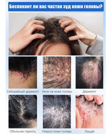 LYDIMOON Shampoo from dandruff removes the itching of the scalp 300 ml - Buy Online on GoSupps.com