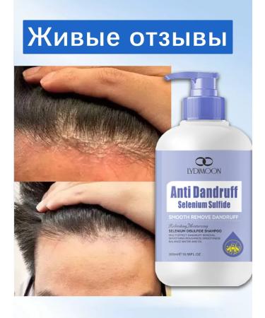 LYDIMOON Shampoo from dandruff removes the itching of the scalp 300 ml - Buy Online on GoSupps.com