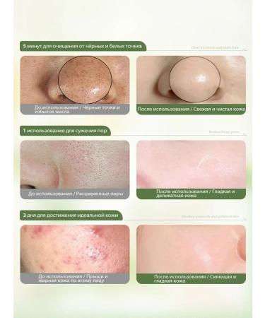 Cleaning mask from black dots and acne for the face - Buy Online on GoSupps.com