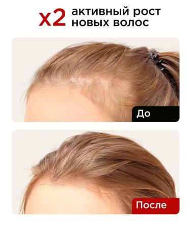 DRSKINVITA Hair growth shampoo delicate care and purification - Buy Online on GoSupps.com