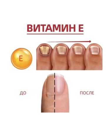 Nail growth regenerator suppress fungi Care 10 ml - Buy Online on GoSupps.com