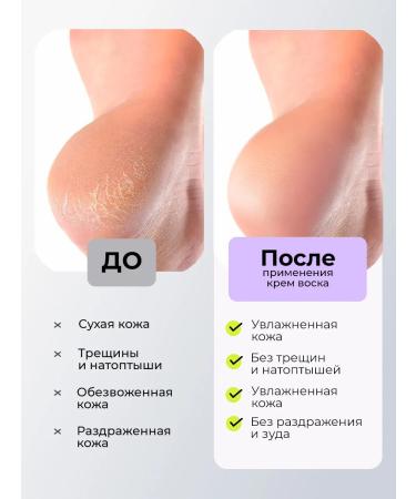 LIVSI A set of multipenka for arms and legs wax and a pedicure scrub - Buy Online on GoSupps.com