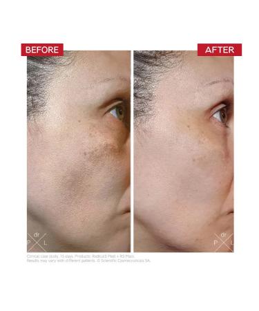 DR LEVY SWITZERLAND Radical3 Reboot Proel Radical3 - Buy Online on GoSupps.com