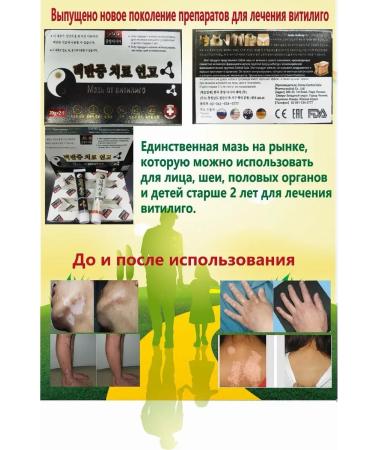 Apoli Vitiligo ointment Chinese - Buy Online on GoSupps.com
