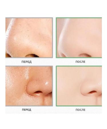 Quasi Bio Collagen Mask Moisturization against Wrinkles Glass - Buy Online on GoSupps.com