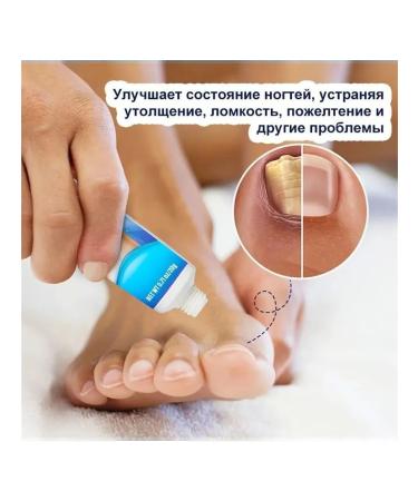 2*20 g of ointments from nail fungus to eliminate inflammation - Buy Online on GoSupps.com
