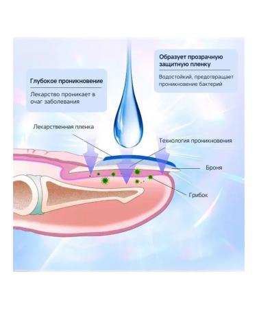2*20 g of ointments from nail fungus to eliminate inflammation - Buy Online on GoSupps.com