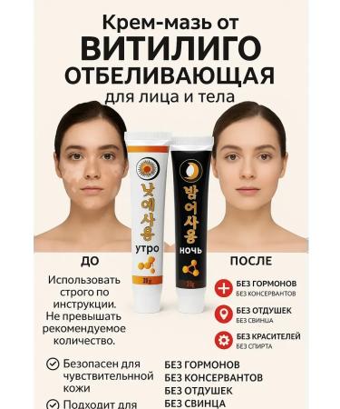 Tissuespam Vitiligo ointment from pigment spots on the face