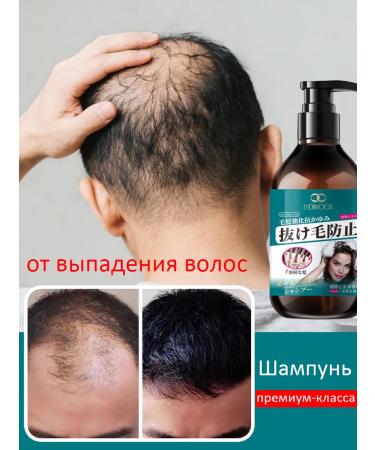 LYDIMOON Professional shampoo from male hair loss and women