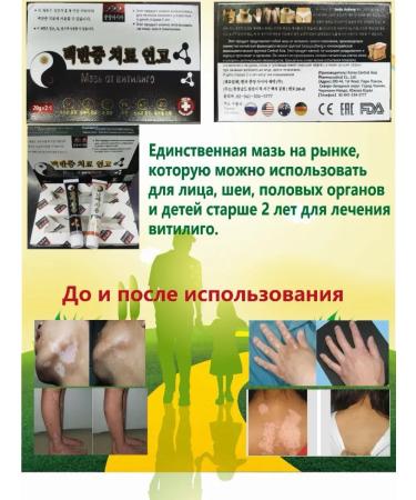 Lopez Ointment from Vitivli - Buy Online on GoSupps.com