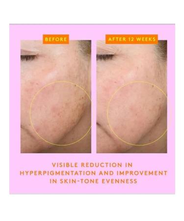 Drunk Elephant Facial serum with vitamin C 28 ml - Buy Online on GoSupps.com