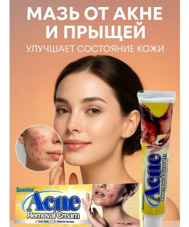 ANEL 1 Acne and acne ointment