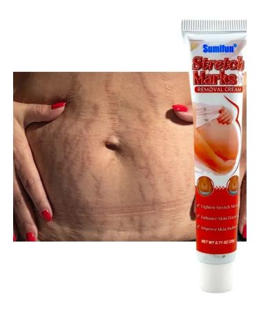 Golden Apple Body stretch marks for pregnant women and adolescents - Buy Online on GoSupps.com