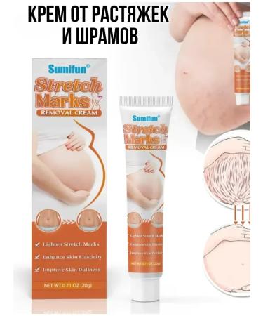 Chinese miracle ointment Cream from stretch marks and scars during pregnancy on the stomach of the chest