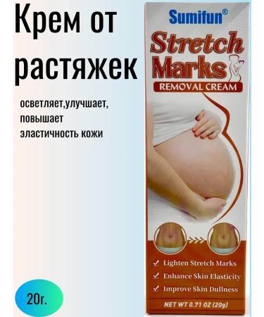 TAIS stretch mark cream Stretching cream for pregnant women lights up stretch marks