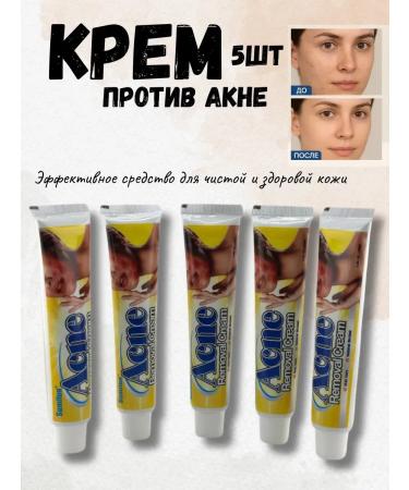 DDE intensive Acne Cream 5pcs