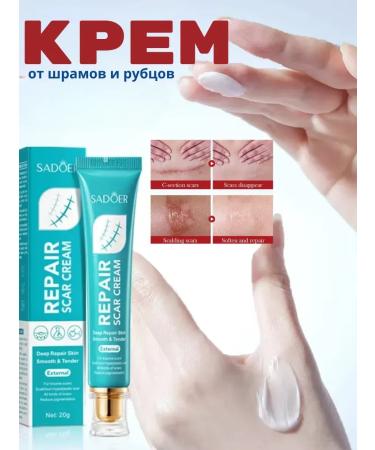 ACTIVITY Cream from scars and scars skin regeneration