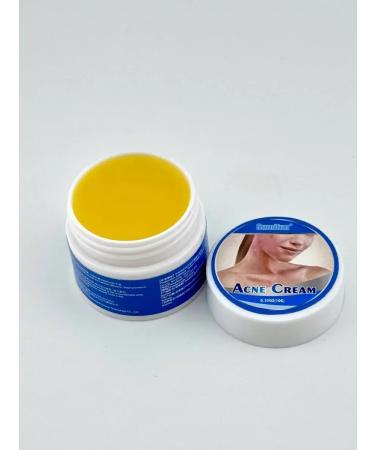 DDE intensive Acne cream acne and skin inflammation - Buy Online on GoSupps.com