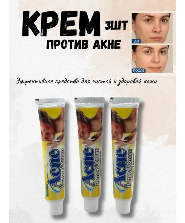 DDE intensive Acne cream 3pcs