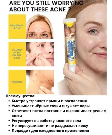 Vlar BEAUTY Acne cream on the face ointment against acne 3 pcs - Buy Online on GoSupps.com