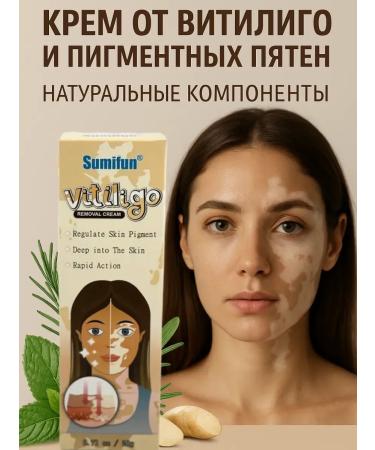 ANEL 1 Vitiligo cream and age spots - 3pcs