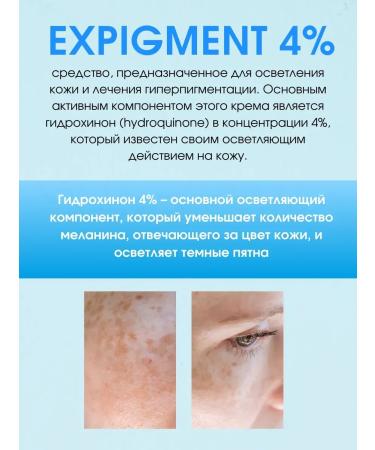 NazzHome Cream from post -acne and acne lightening from stains on the face - Buy Online on GoSupps.com