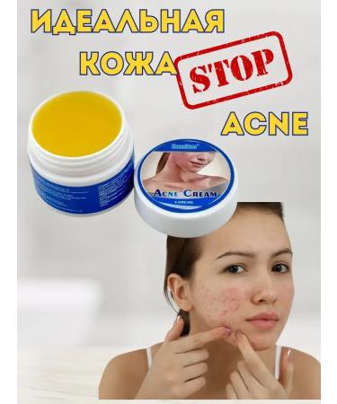 Gintensive Acne cream and acne on the face and body