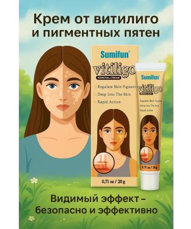 Dubai luxury Vitiligo cream - to restore skin pigmentation 1 pcs