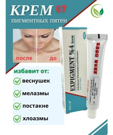 Black Friday Facial cream whitening pigmentation from freckles