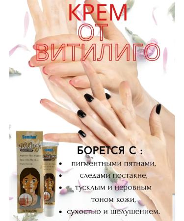 Leila vitiligo cream