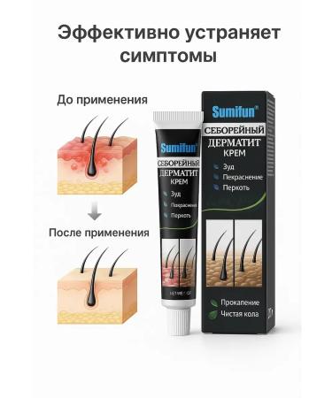 TIA Cream from seborrheic dermatitis on the head and face - Buy Online on GoSupps.com