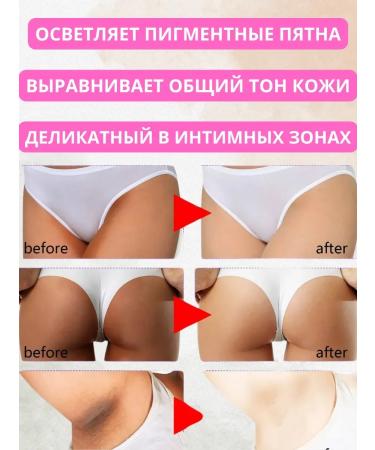 RIVON Whitening cream for an intimate zone - Buy Online on GoSupps.com