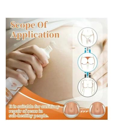 Nail25 beauty and health Stretching cream after pregnancy - Buy Online on GoSupps.com