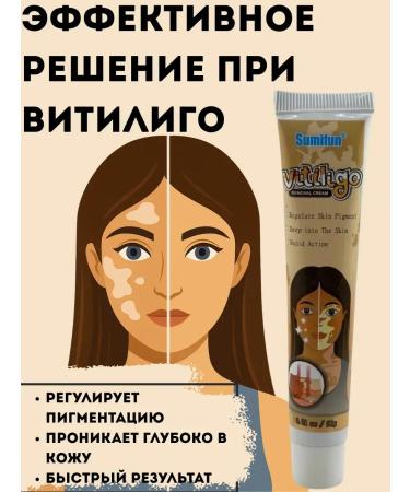 COME 3 Vitiligo cream