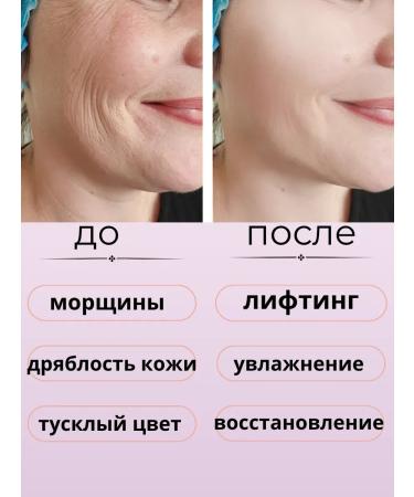 NK1314 Facial cream anti -aging moisturizer with snake venom - Buy Online on GoSupps.com