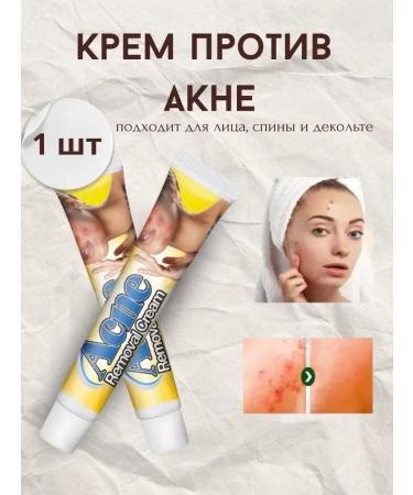 SLana2 Acne and acne cream