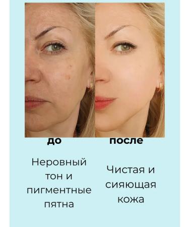 NK1314 Lightening face cream for age spots and freckles 5 pcs. - Buy Online on GoSupps.com