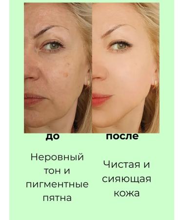 NK1314 Clarifying cream from age spots and freckles 3 pcs - Buy Online on GoSupps.com