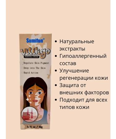 Ouch Vitiligo cream a remedy for white spots on the face and body - Buy Online on GoSupps.com