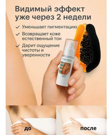 Aku15 Whitening cream for intimate zones and bodies - Buy Online on GoSupps.com